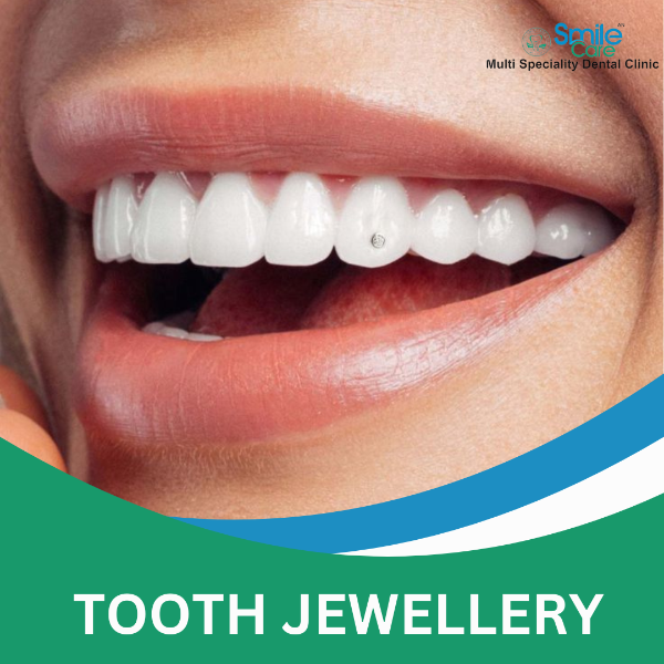 TOOTH JEWELLERY