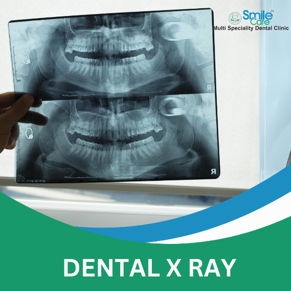 DENTAL X RAY