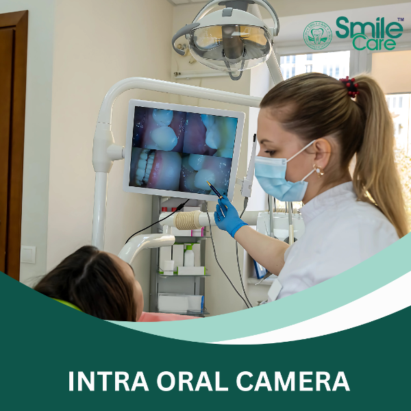 INTRA ORAL CAMERA