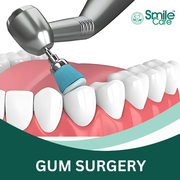 GUM SURGERY