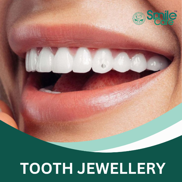 TOOTH JEWELLERY