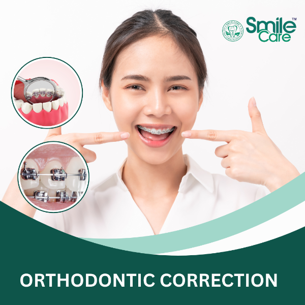 ORTHODONTIC CORRECTION