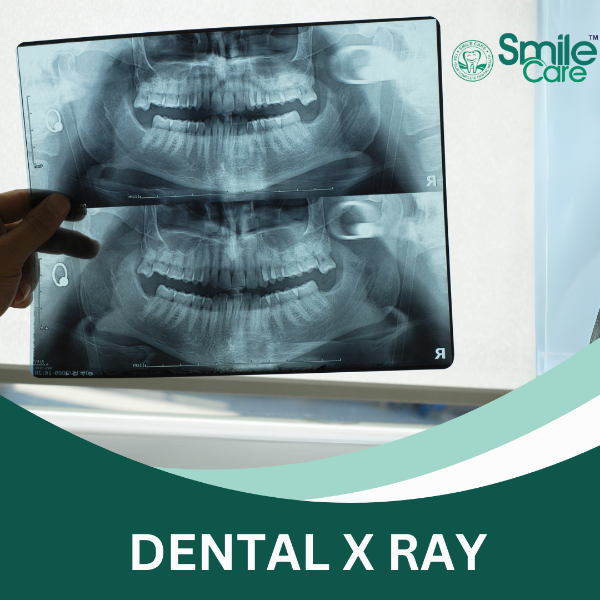 DENTAL X RAY