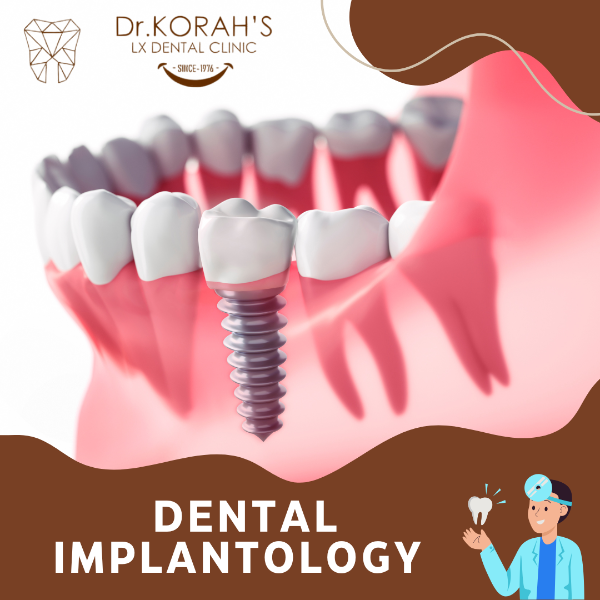 DENTAL IMPLANTOLOGY