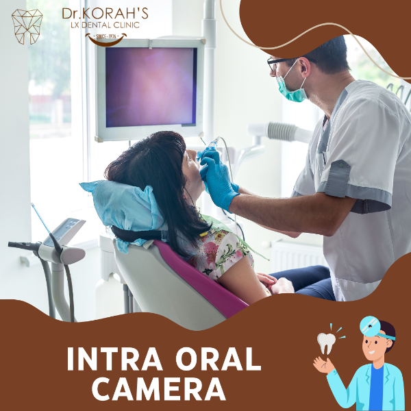 INTRA ORAL CAMERA