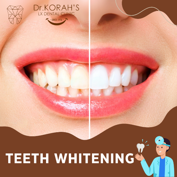 TEETH WHITENING