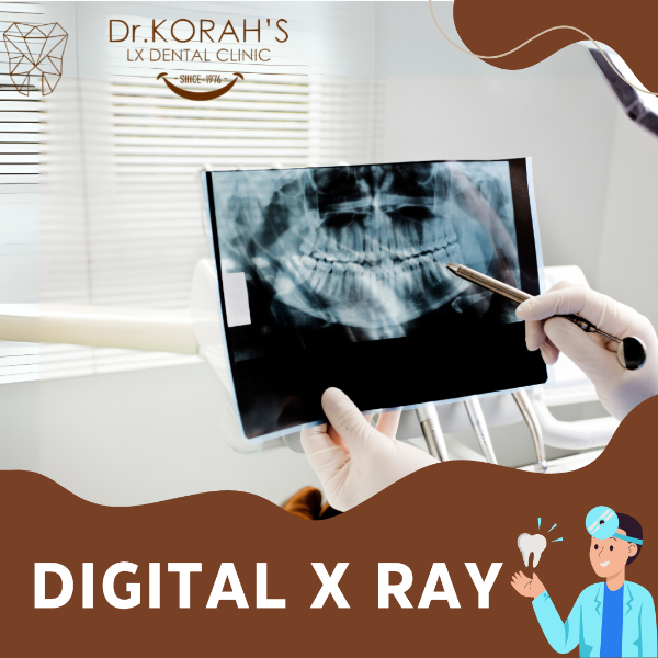 DIGITAL X RAY