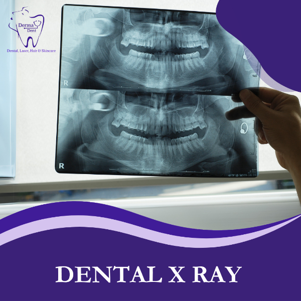 DENTAL X RAY
