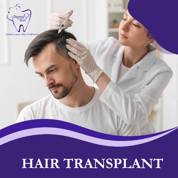 HAIR TRANSPLANT