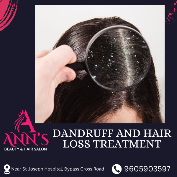 DANDRUFF AND HAIR LOSS TREATMENT