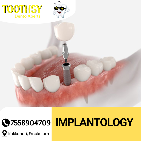 Implantology