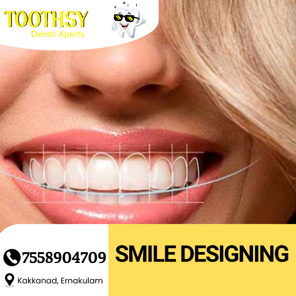 Smile Designing