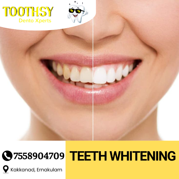 Teeth Whitening