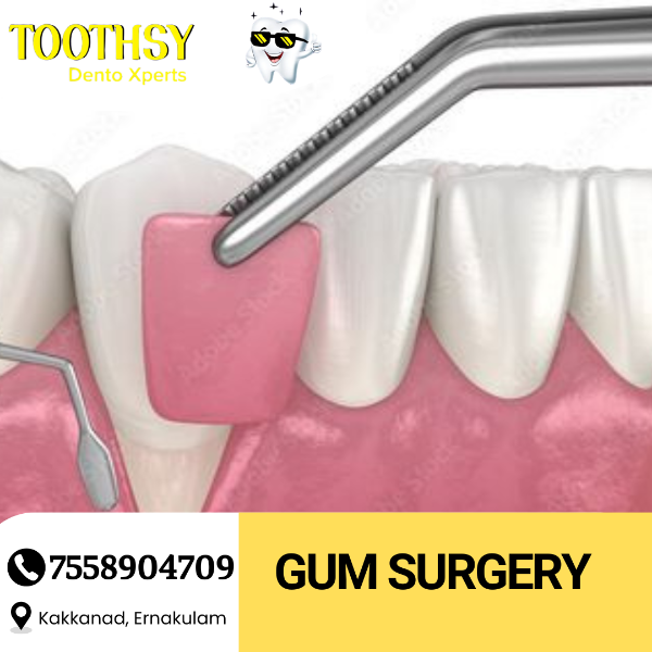 Gum Surgery