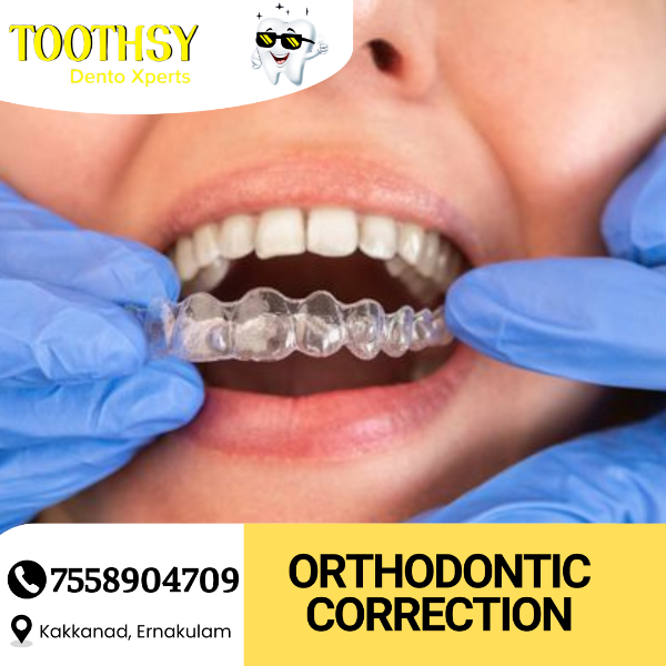 Orthodontic correction