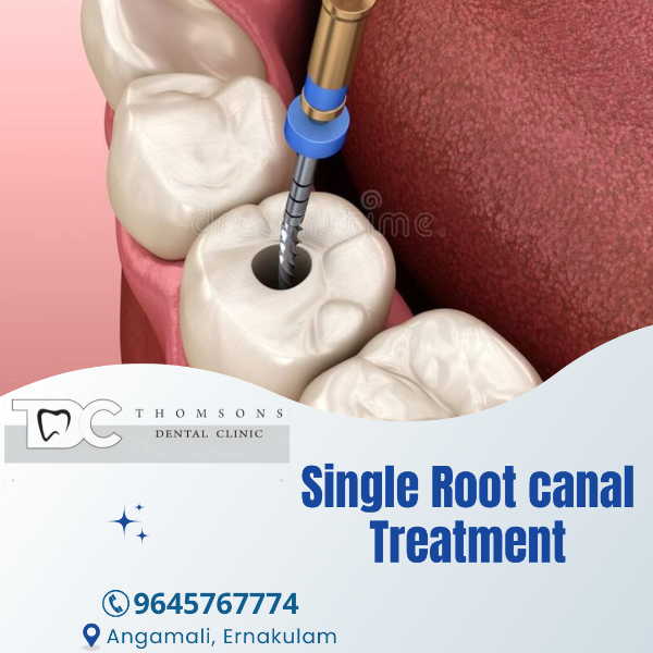 Single Root canal Treatment
