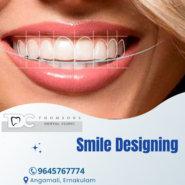 Smile Designing