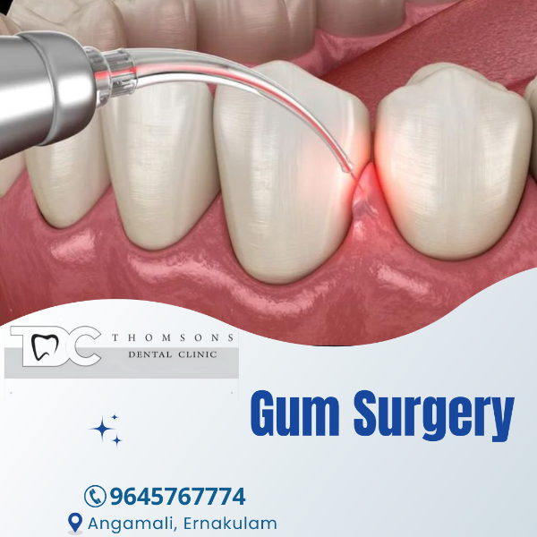 Gum Surgery