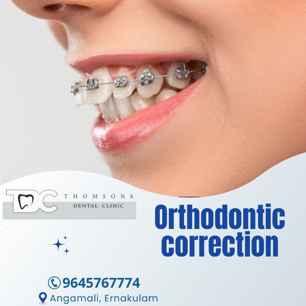 Orthodontic correction