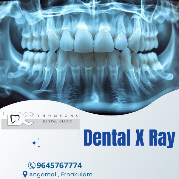 Dental X Ray