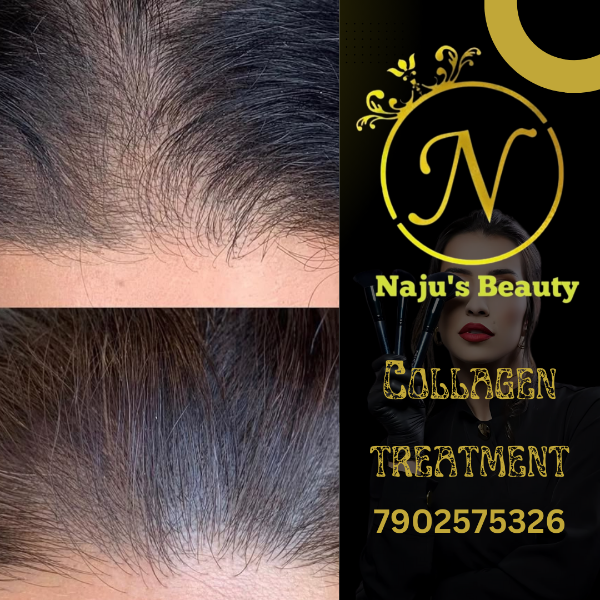 Collagen treatment