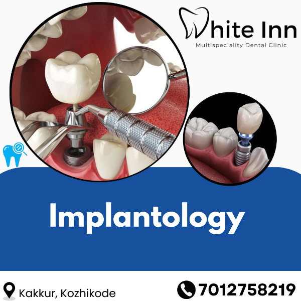 Implantology