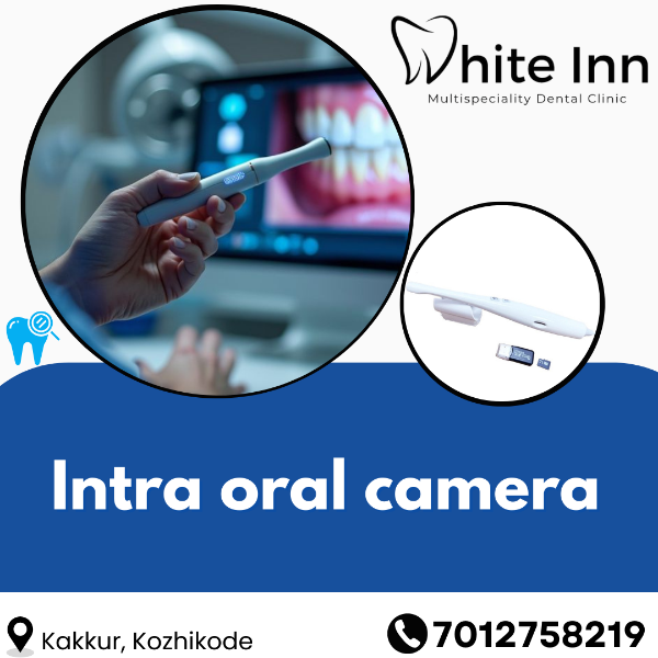 Intra oral camera