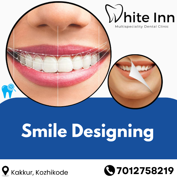 Smile Designing