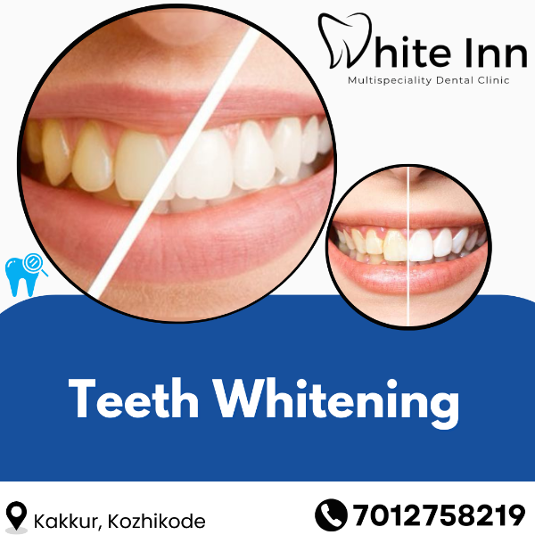 Teeth Whitening