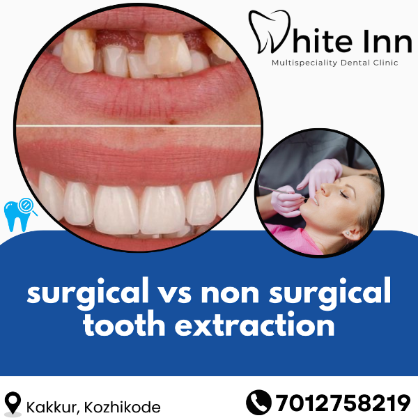 surgical vs non surgical tooth extraction