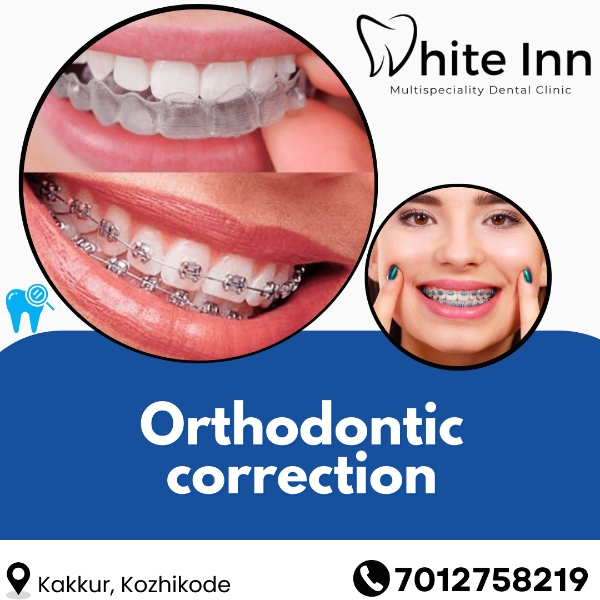 Orthodontic correction