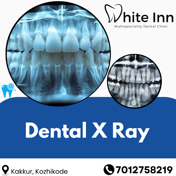 Dental X Ray