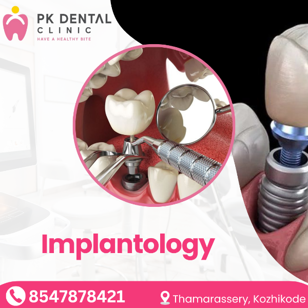 Implantology