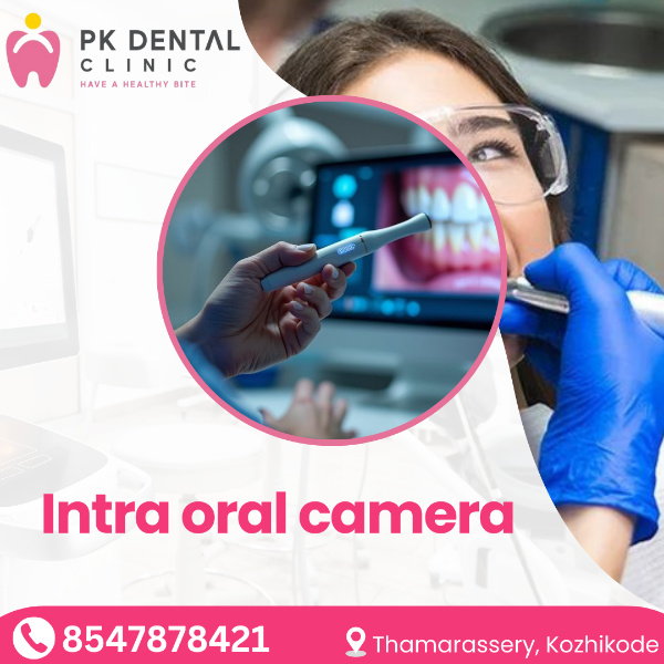 Intra oral camera