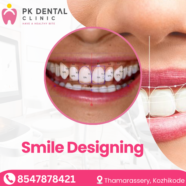 Smile Designing