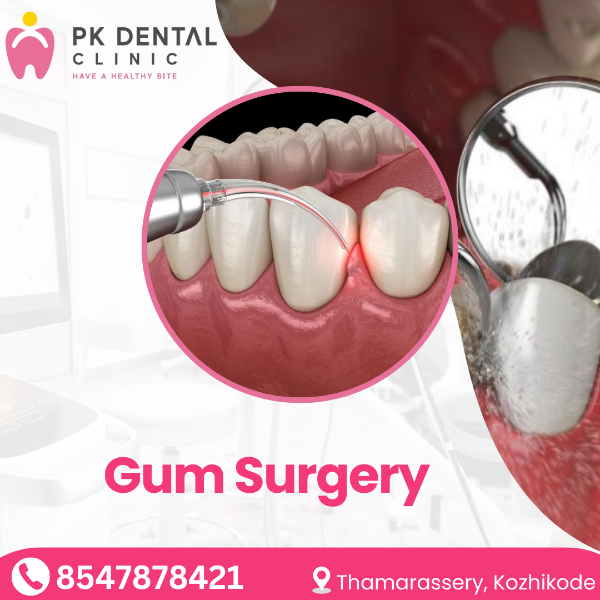Gum Surgery