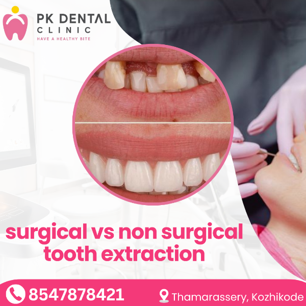 surgical vs non surgical tooth extraction