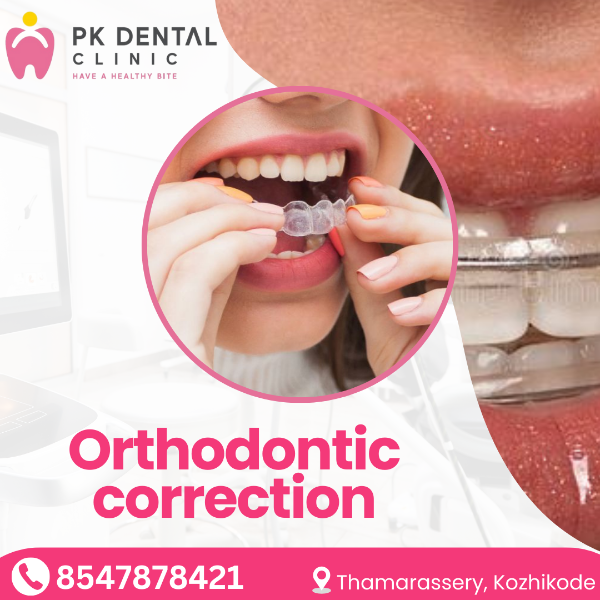 Orthodontic correction