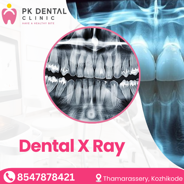 Dental X Ray