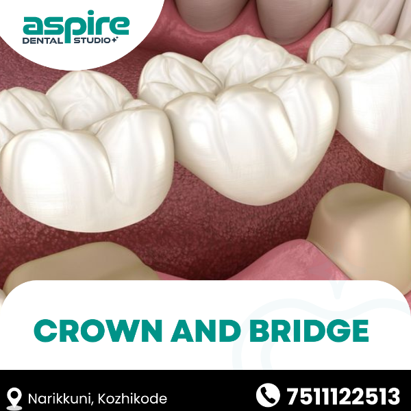 Crown and Bridge