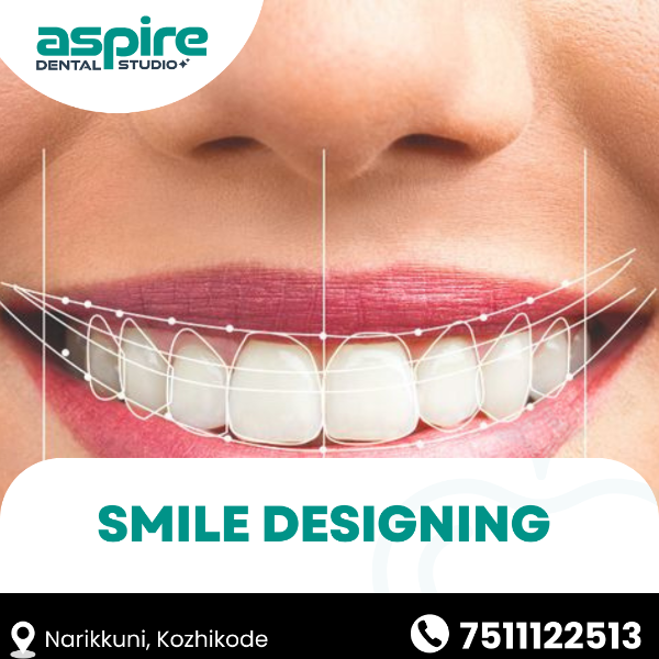 Smile Designing