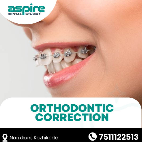 Orthodontic correction