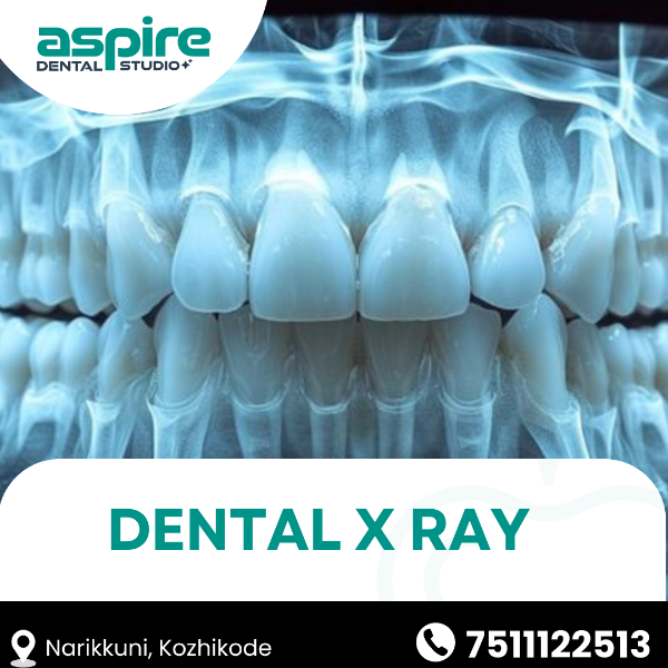 Dental X Ray