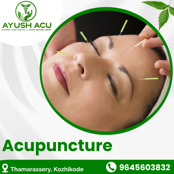 Acupuncture