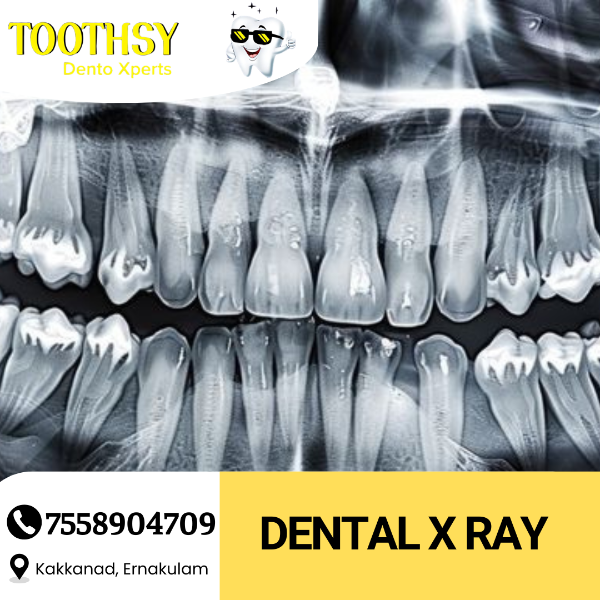 Dental X Ray