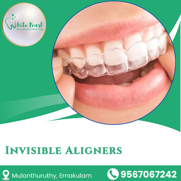 Invisible Aligners