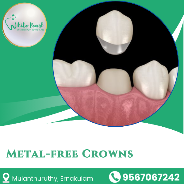 Metal-free Crowns