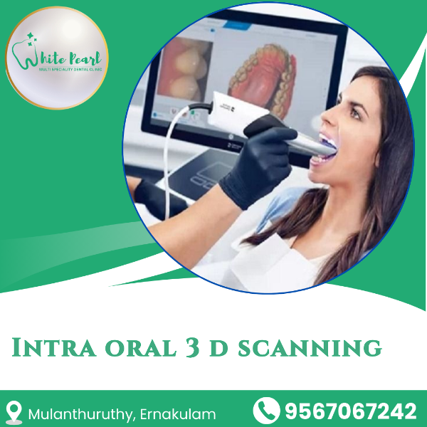 Intra oral 3 d scanning