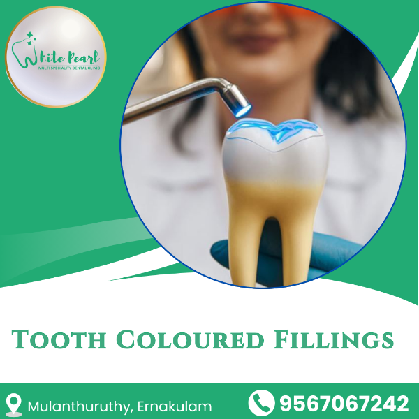 Tooth Coloured Fillings