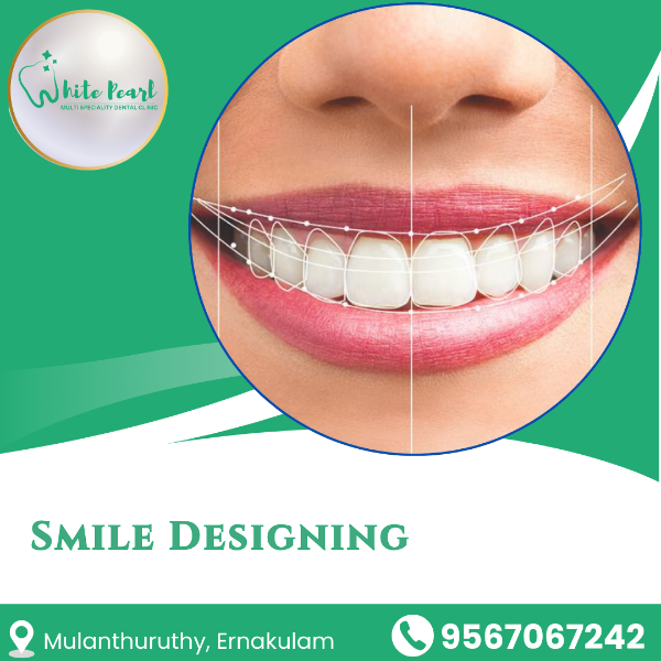 Smile Designing